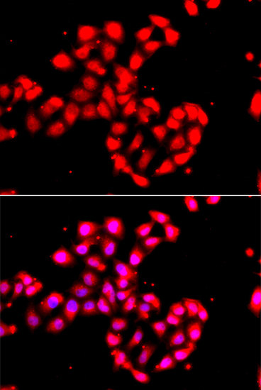 CAMK1D Rabbit Polyclonal Antibody