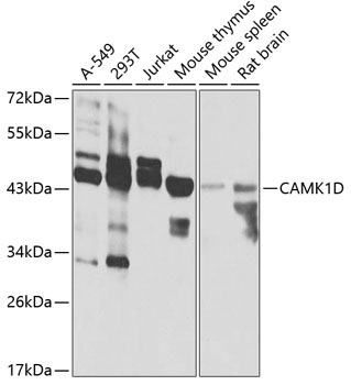 CAMK1D Rabbit Polyclonal Antibody