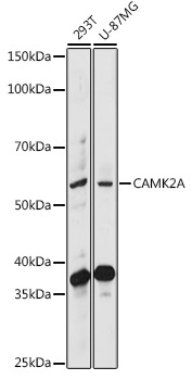 CAMK2A Rabbit Polyclonal Antibody