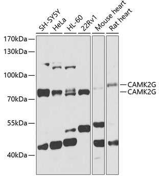 CAMK2G Rabbit Polyclonal Antibody