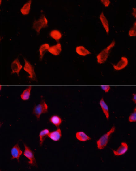 CAMK2G Rabbit Polyclonal Antibody