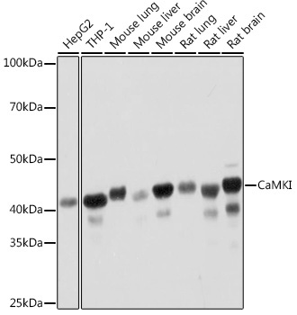 CaMKI Rabbit Monoclonal Antibody