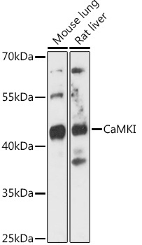 CaMKI Rabbit Polyclonal Antibody