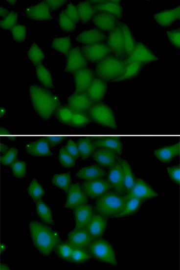 CaMKI Rabbit Polyclonal Antibody