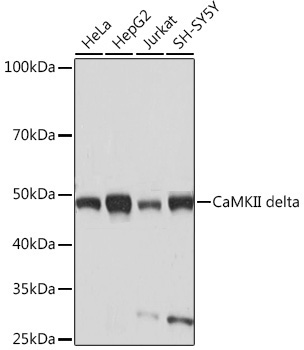 CaMKII delta Rabbit Monoclonal Antibody