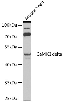 CaMKII delta Rabbit Polyclonal Antibody
