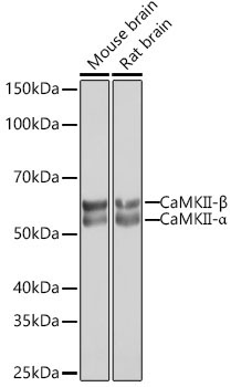 CaMKII Rabbit Monoclonal Antibody