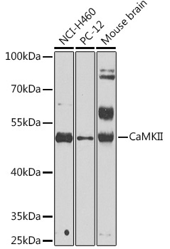 CaMKII Rabbit Polyclonal Antibody