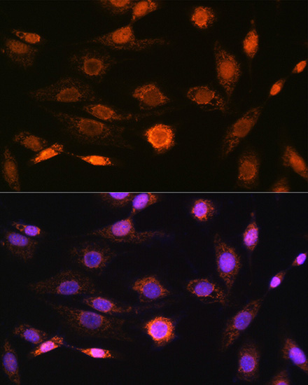 CAMKIV Rabbit Monoclonal Antibody