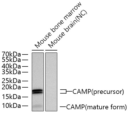 CAMP Rabbit Polyclonal Antibody