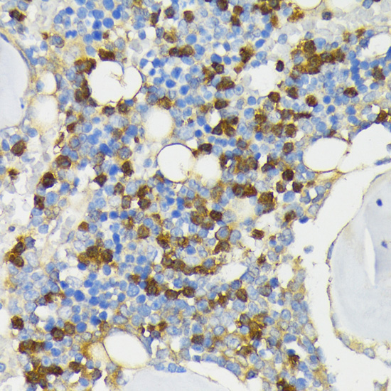 CAMP Rabbit Polyclonal Antibody - Image 2