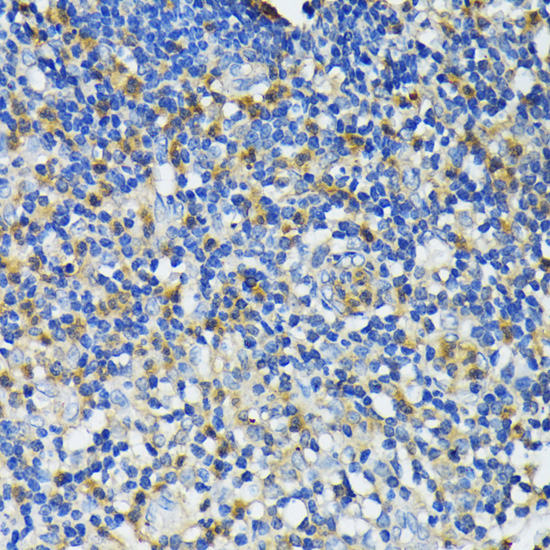CAMP Rabbit Polyclonal Antibody - Image 3