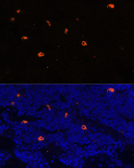 CAMP Rabbit Polyclonal Antibody - Image 4