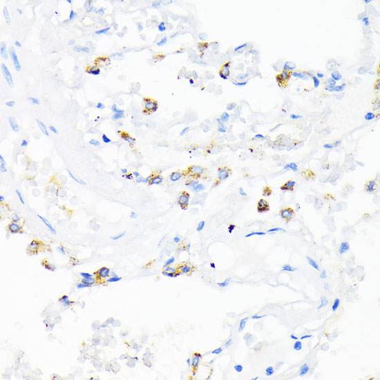 CAMP Rabbit Polyclonal Antibody - Image 4