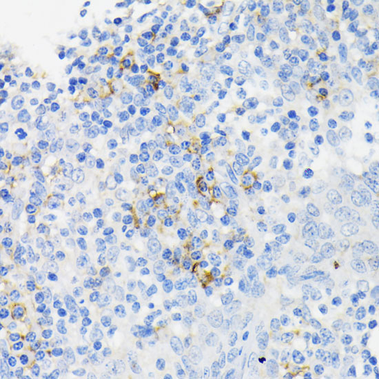 CAMP Rabbit Polyclonal Antibody - Image 6