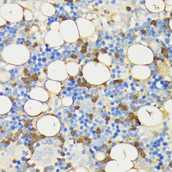 CAMP Rabbit Polyclonal Antibody
