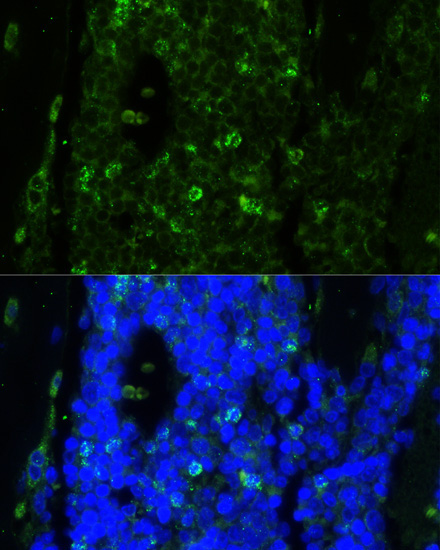 CAMP Rabbit Polyclonal Antibody - Image 3