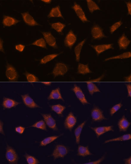 CAMSAP1 Rabbit Polyclonal Antibody - Image 2