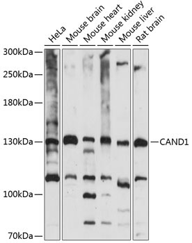 CAND1 Rabbit Polyclonal Antibody