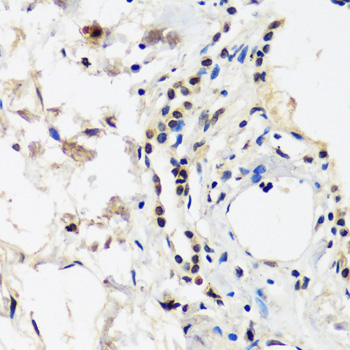 CAND1 Rabbit Polyclonal Antibody - Image 2