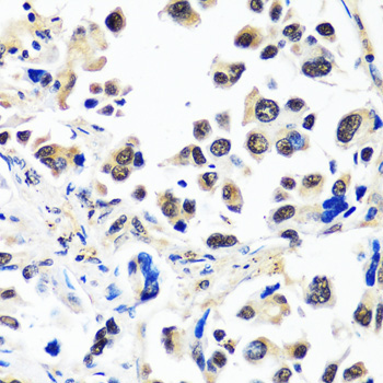 CAND1 Rabbit Polyclonal Antibody - Image 3