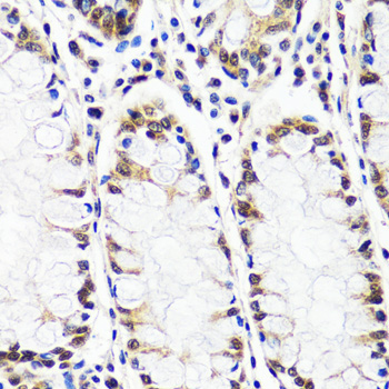 CAND1 Rabbit Polyclonal Antibody - Image 4