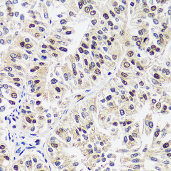 CAND1 Rabbit Polyclonal Antibody - Image 5