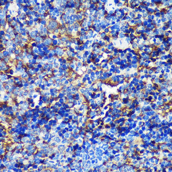 CAND2 Rabbit Polyclonal Antibody - Image 2