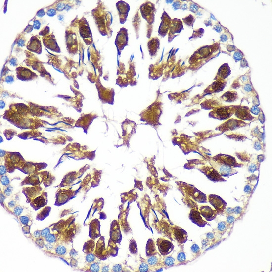 CAND2 Rabbit Polyclonal Antibody - Image 3