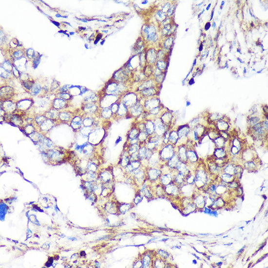 CAND2 Rabbit Polyclonal Antibody - Image 4