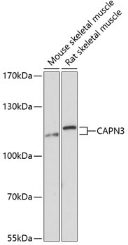 CAPN3 Rabbit Polyclonal Antibody