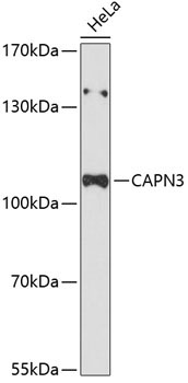 CAPN3 Rabbit Polyclonal Antibody