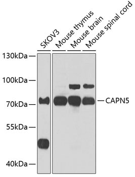 CAPN5 Rabbit Polyclonal Antibody