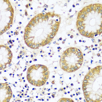 CAPN9 Rabbit Polyclonal Antibody