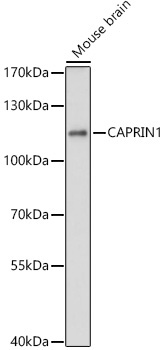 CAPRIN1 Rabbit Polyclonal Antibody - Image 2