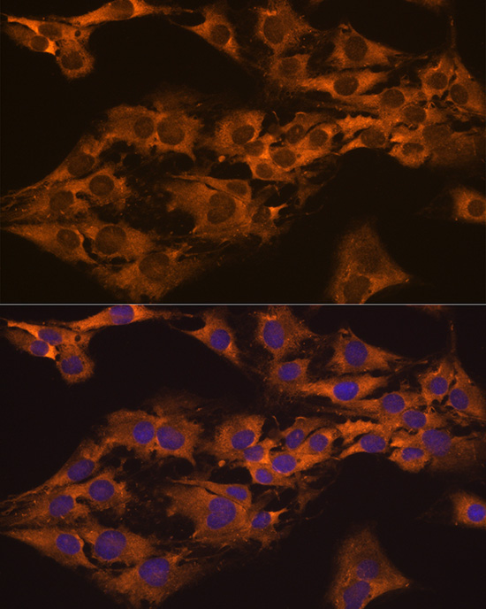 CAPRIN1 Rabbit Polyclonal Antibody - Image 3