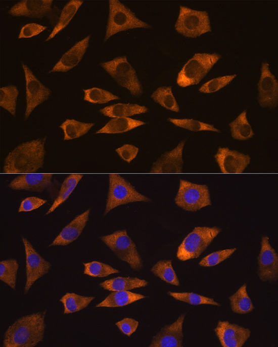 CAPRIN1 Rabbit Polyclonal Antibody - Image 4