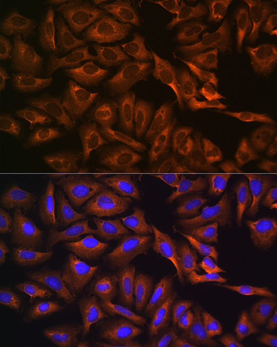 CAPRIN1 Rabbit Polyclonal Antibody - Image 5