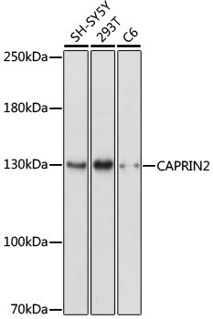CAPRIN2 Rabbit Polyclonal Antibody
