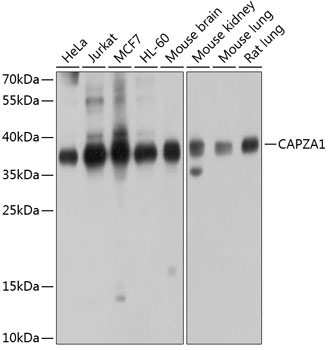 CAPZA1 Rabbit Polyclonal Antibody