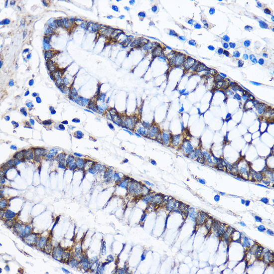 CAPZA2 Rabbit Polyclonal Antibody - Image 3