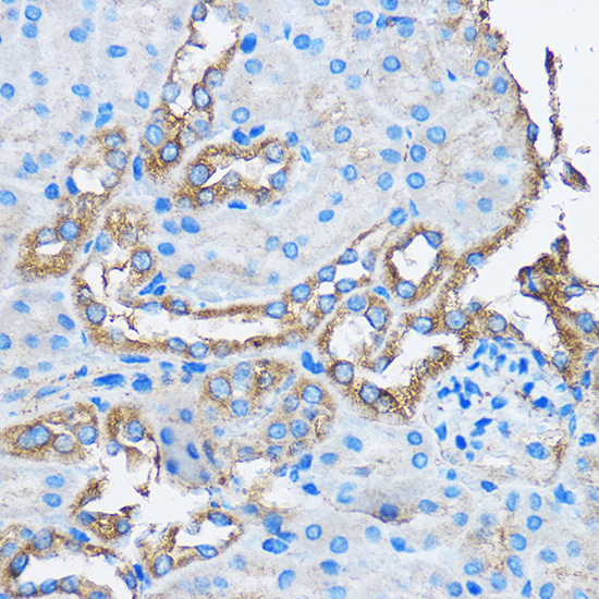 CAPZA2 Rabbit Polyclonal Antibody - Image 4