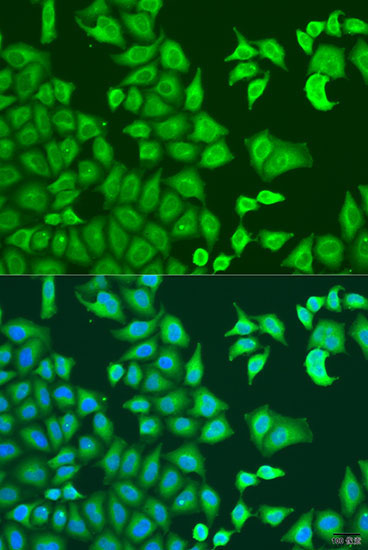 CAPZB Rabbit Polyclonal Antibody - Image 2