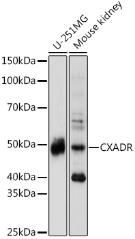 CAR/CXADR Rabbit Polyclonal Antibody