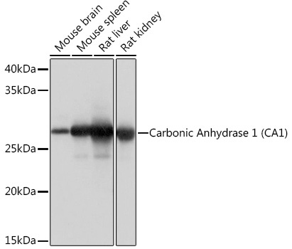 Carbonic Anhydrase 1 (CA1) Rabbit Monoclonal Antibody