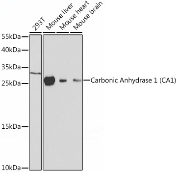 Carbonic Anhydrase 1 (CA1) Rabbit Polyclonal Antibody