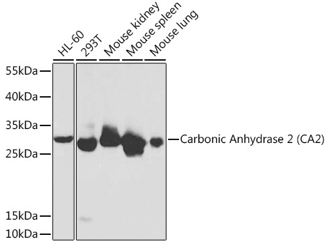 Carbonic Anhydrase 2 (CA2) Rabbit Polyclonal Antibody