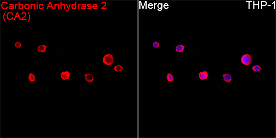 Carbonic Anhydrase 2 (CA2) Rabbit Polyclonal Antibody - Image 2