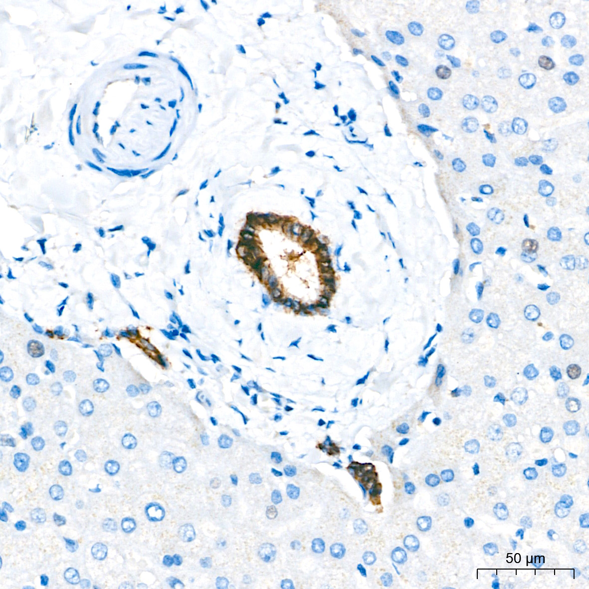 Carbonic Anhydrase 9 (CA9/G250) Rabbit Polyclonal Antibody