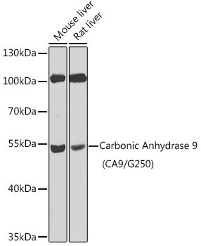 Carbonic Anhydrase 9 (CA9/G250) Rabbit Polyclonal Antibody
